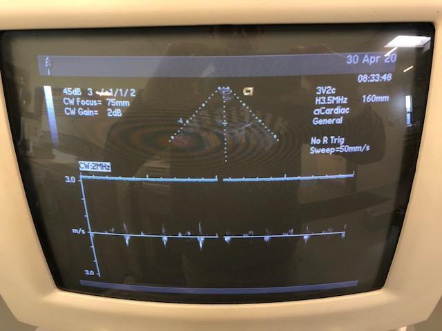 SIEMENS Sequoia C256