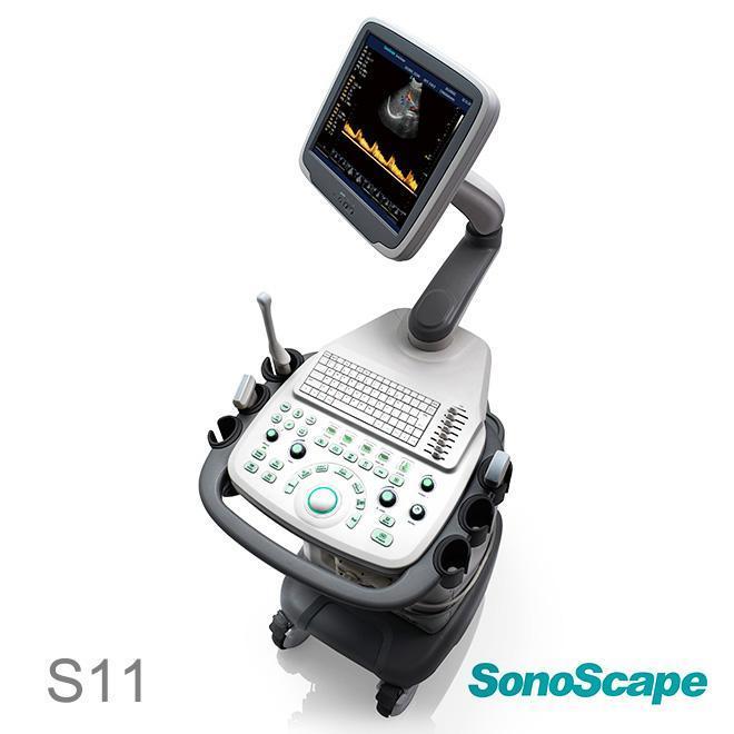 SONOSCAPE S11