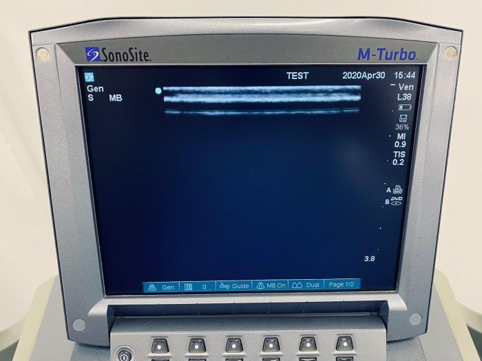 SONOSITE M-Turbo