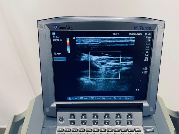 SONOSITE M-Turbo