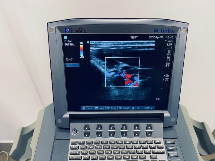 SONOSITE M-Turbo