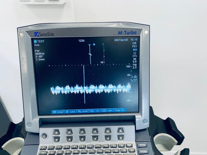 SONOSITE M-Turbo