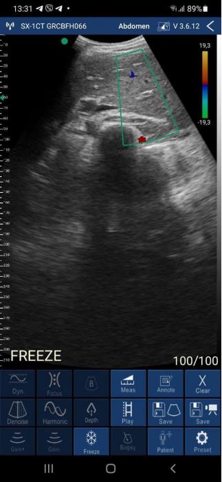 SONOSTAR C4PL