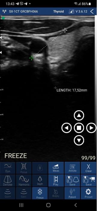 SONOSTAR C4PL