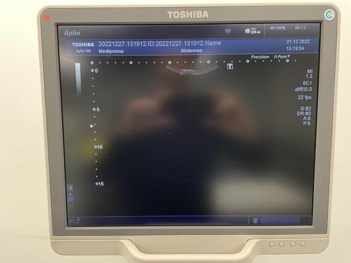 TOSHIBA Aplio 500