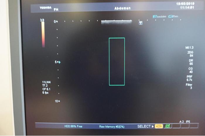 TOSHIBA Aplio XG SSA-790A