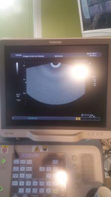 Used TOSHIBA Xario XG OB / GYN – Vascular Ultrasound