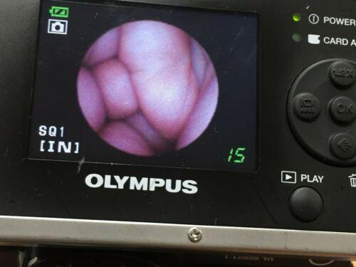 OLYMPUS MAF-TM Mobile Airway Intubation Endoscope Endoscopy (1498-s37)_